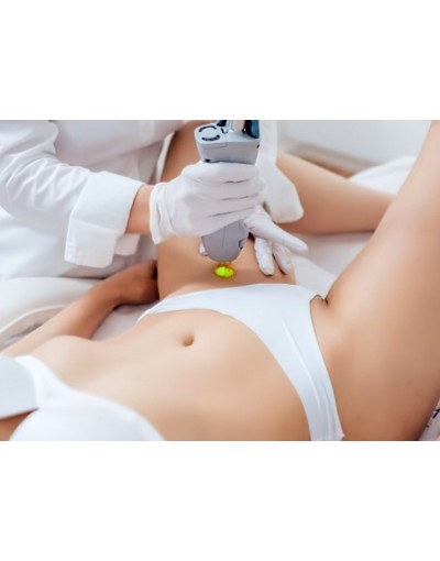 Епилация на бикини линия за жени