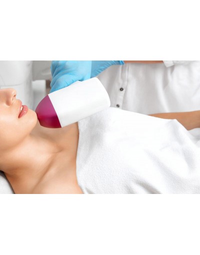 Епилация на брадичка за жени