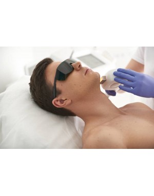 Епилация на брадичка за мъже