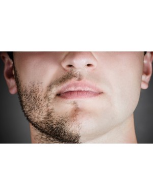 Епилация на цяло лице за мъже