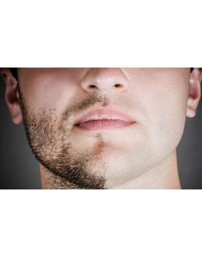 Епилация на цяло лице за мъже