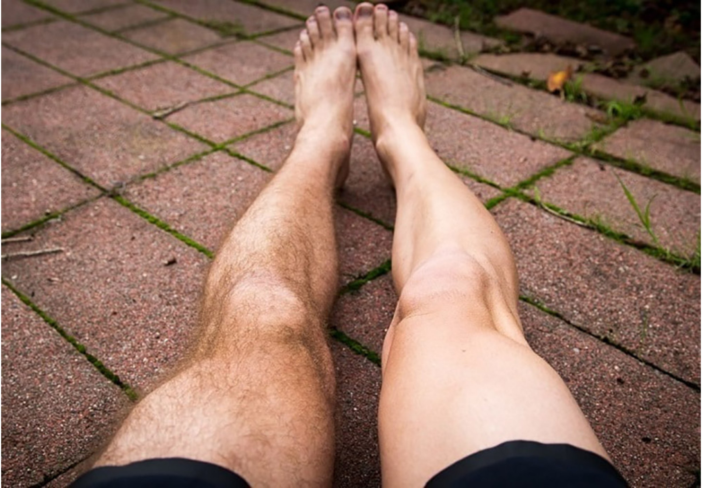 Епилация на цели крака за мъже