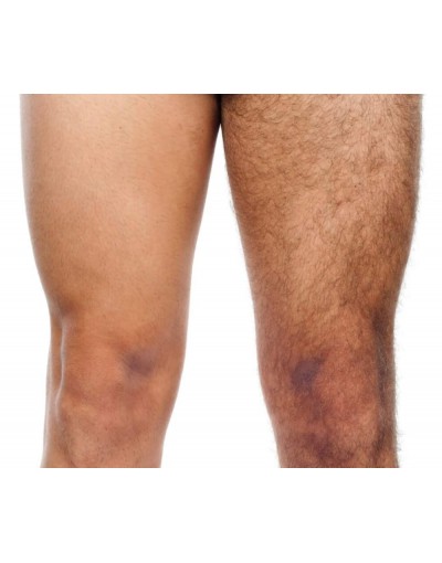 Епилация на бедра и колене за мъже