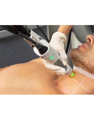 Епилация на шия за мъже