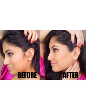 Епилация на бакенбарди за жени Епилация на бакенбарди за жени