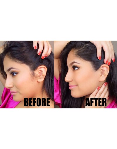 Епилация на бакенбарди за жени