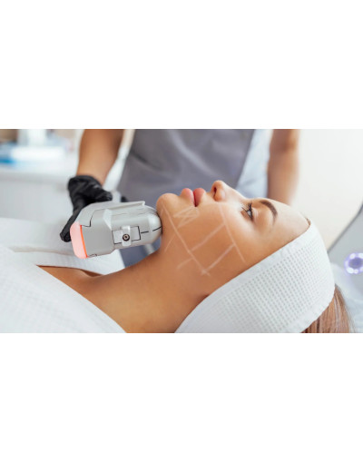 Неоперативен лифтинг HIFU